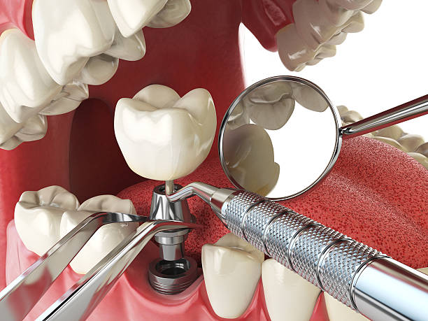 Best Emergency Dental Services for Seniors in Smiths Station, AL